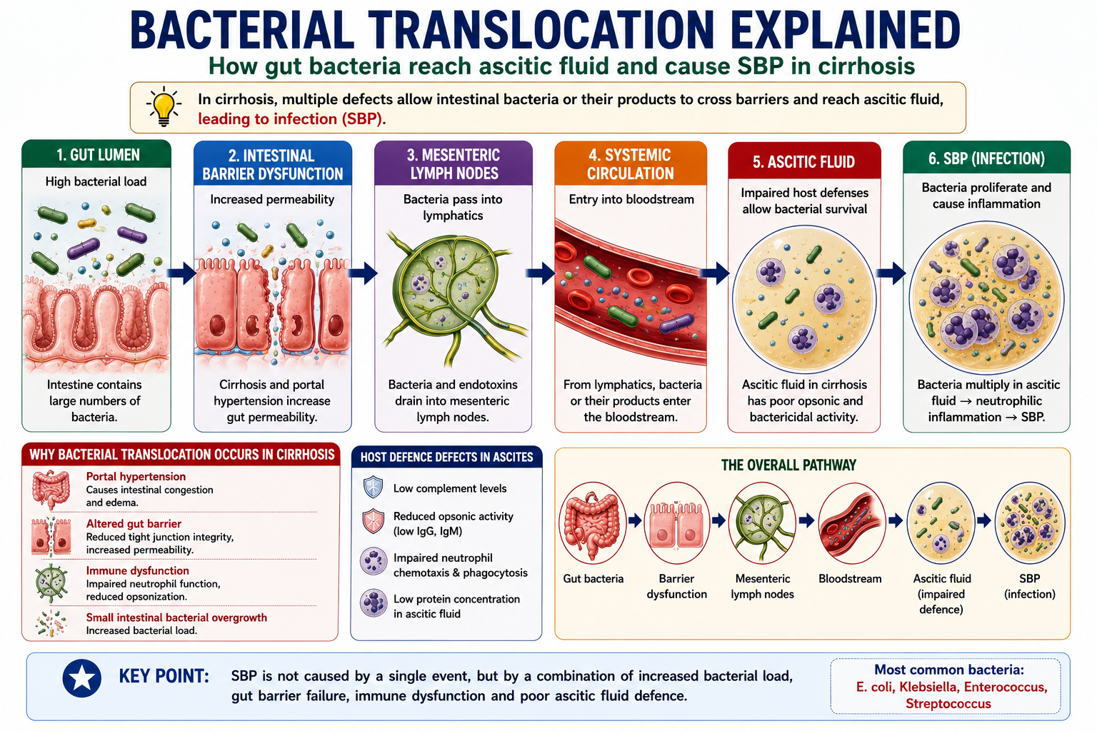 Diagram showing the pathway of bacterial translocation from gut bacteria through intestinal wall mesenteric lymph nodes bloodstream and into ascitic fluid causing SBP