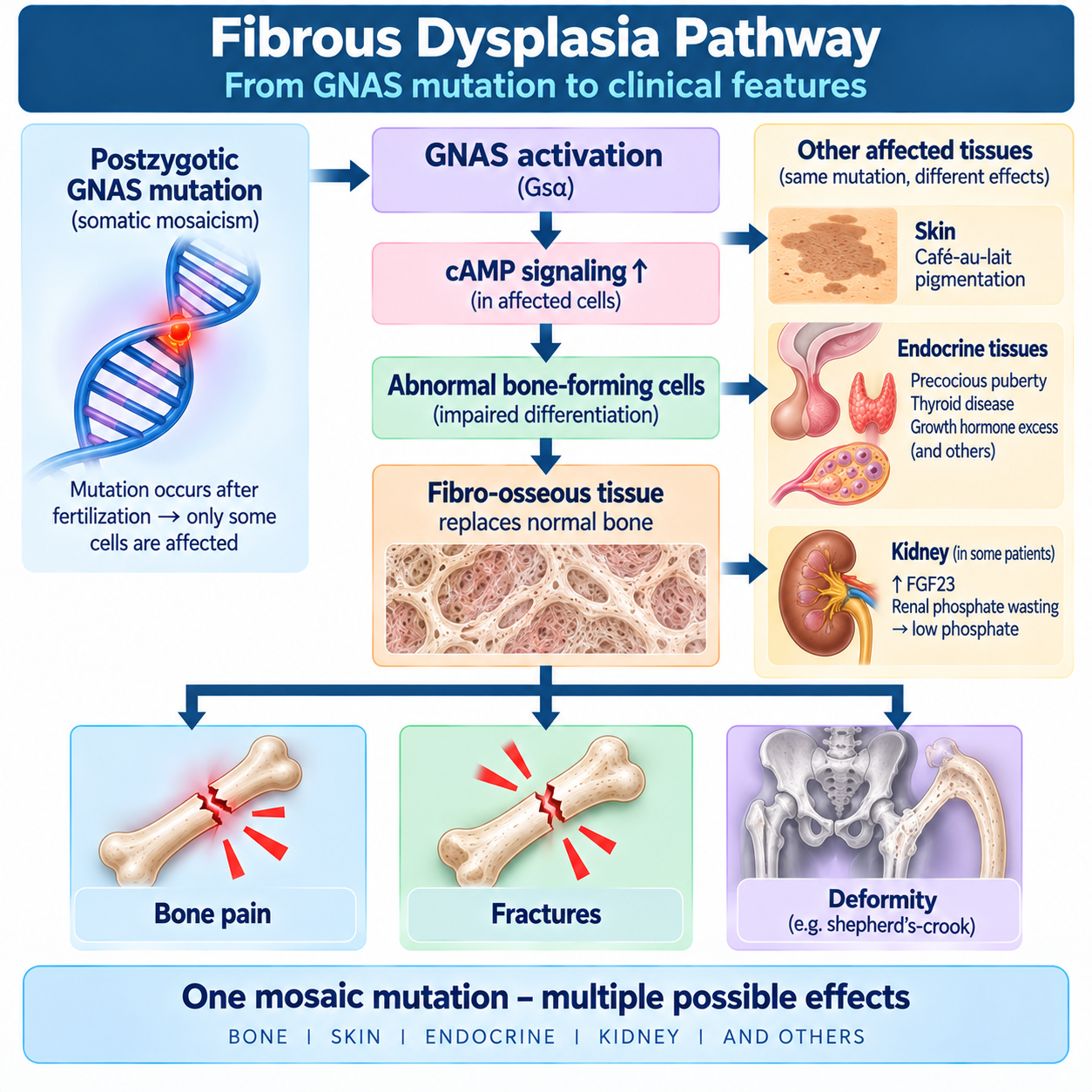 Fibrous dysplasia pathway from activating GNAS mosaicism and increased cAMP signaling to fibro-osseous bone lesions, fracture and deformity.