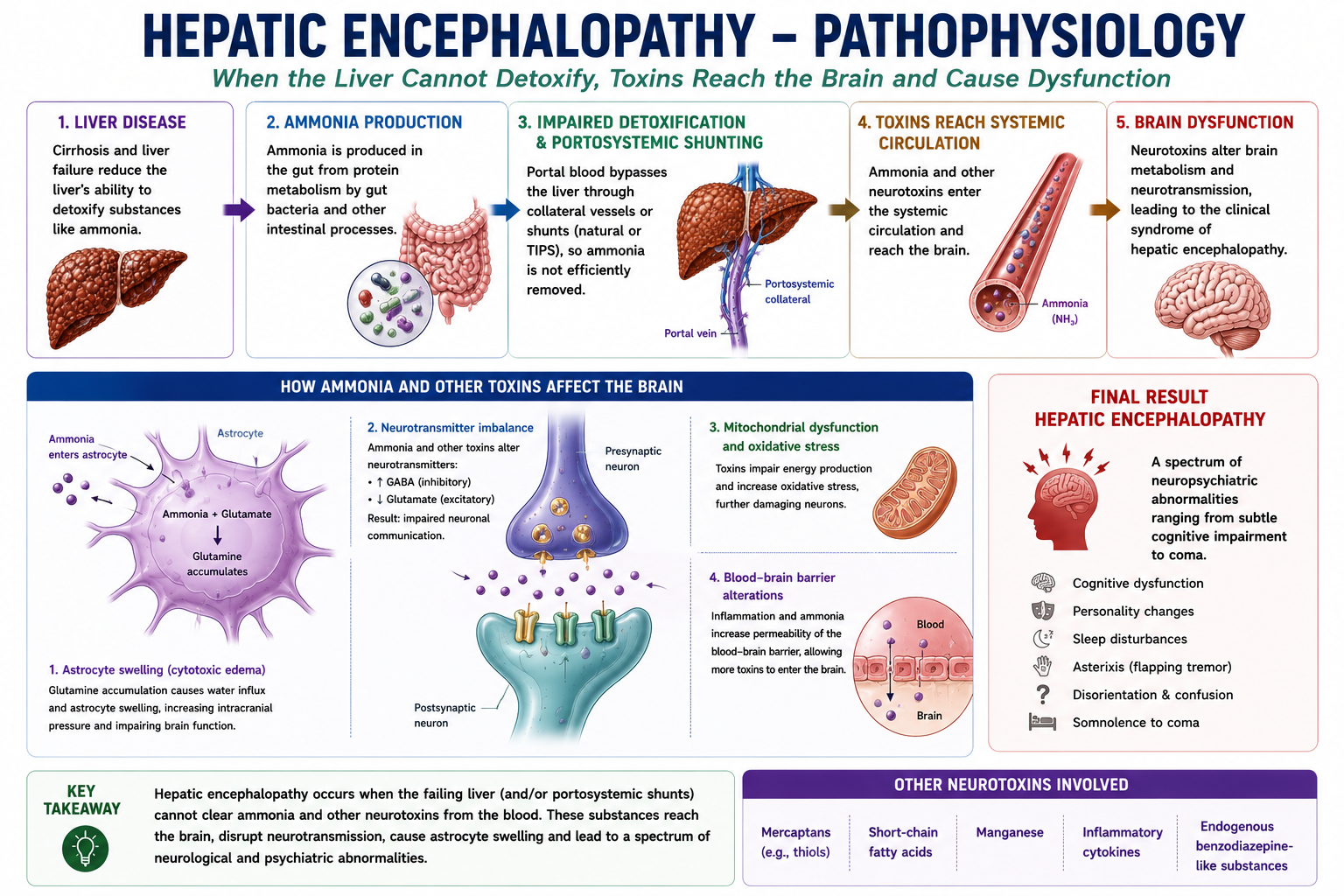 Pathophysiology diagram of hepatic encephalopathy showing cirrhosis impairing liver detoxification and portosystemic shunting allowing ammonia to reach the systemic circulation cross the blood-brain barrier and cause astrocyte swelling and brain dysfunction