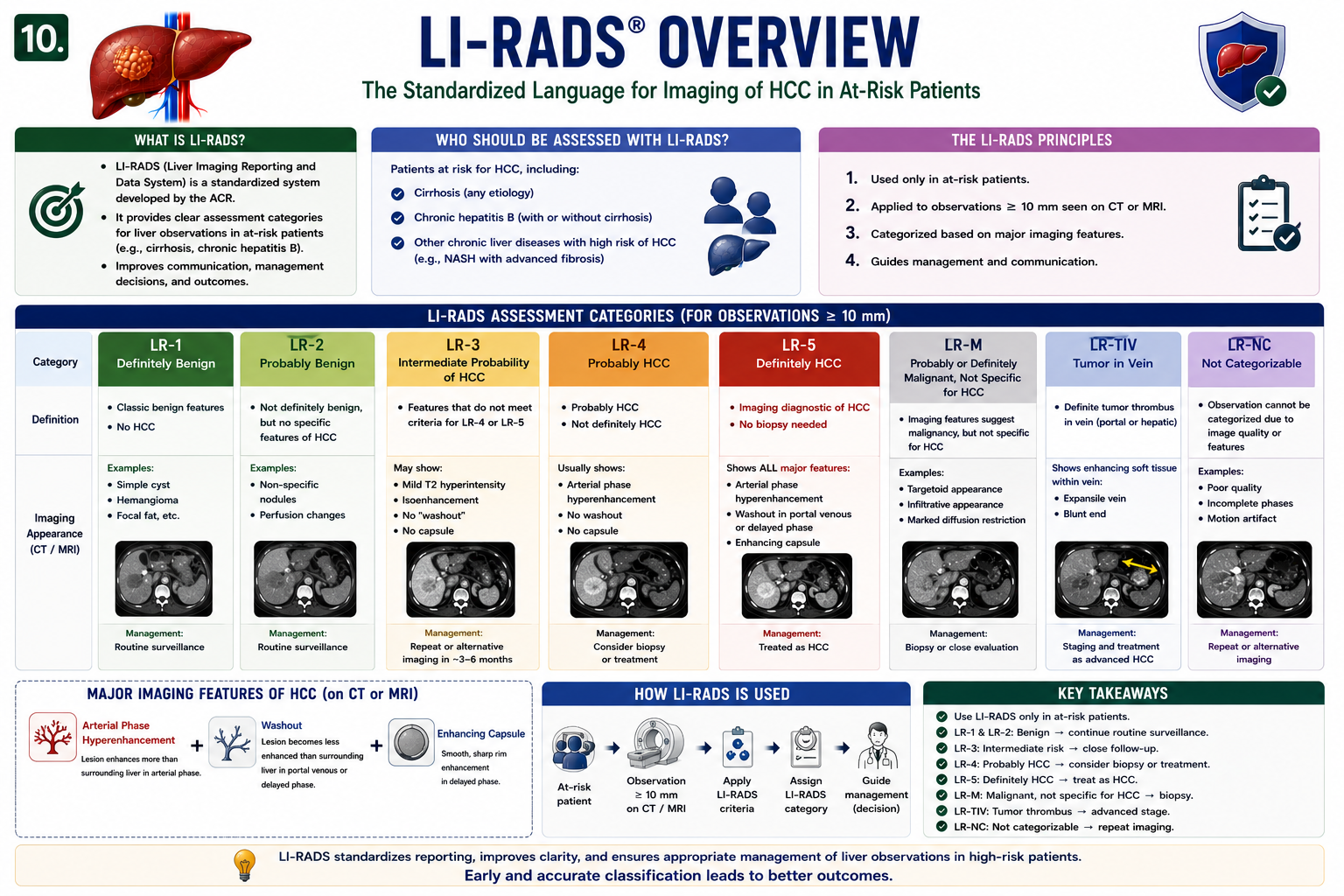 LI-RADS overview showing LR-1 benign through LR-5 definitely hepatocellular carcinoma