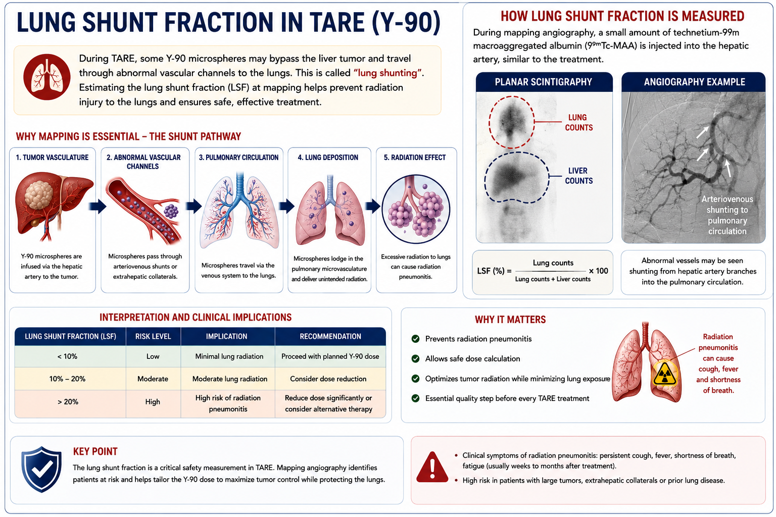 Lung shunt fraction in TARE showing abnormal vascular shunting from liver tumor to lungs