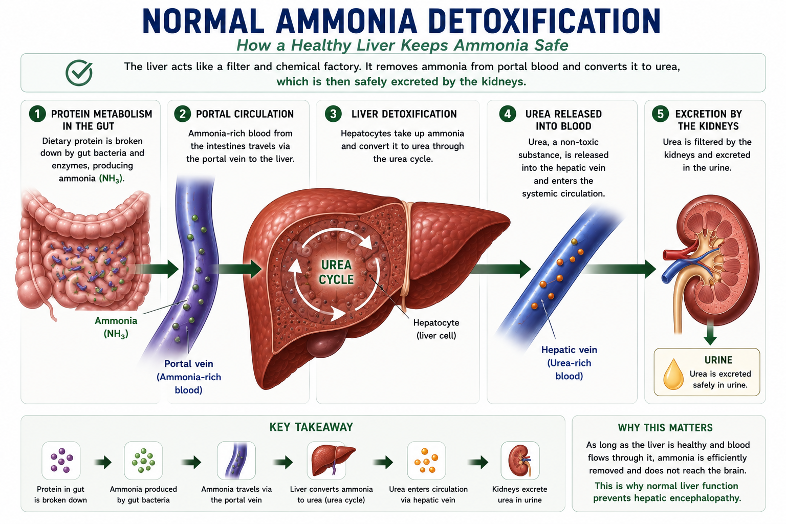 Diagram showing normal ammonia detoxification pathway: gut bacteria produce ammonia which enters the portal vein and is converted to urea by the healthy liver via the urea cycle before safe urinary excretion