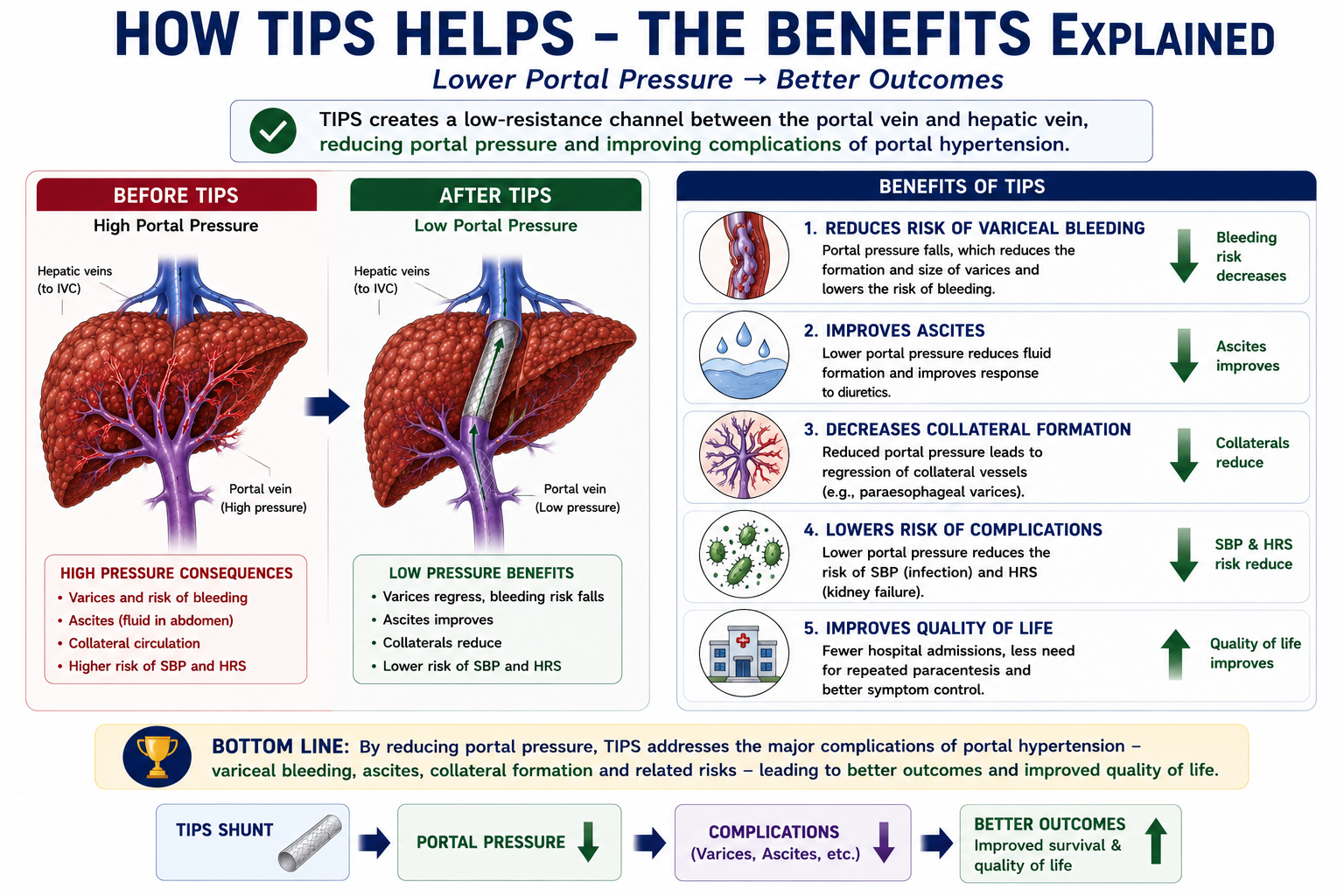 Diagram showing how TIPS lowers portal pressure which in turn reduces variceal bleeding risk improves ascites reduces the need for paracentesis and decreases hospital admissions