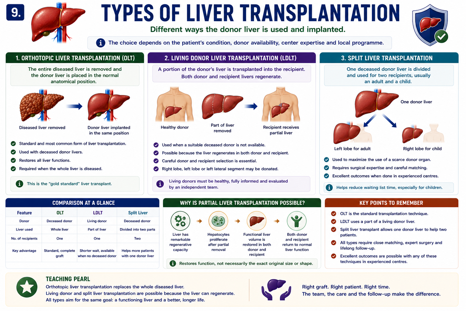 Types of liver transplantation including orthotopic liver transplantation living donor liver transplantation and split liver transplantation