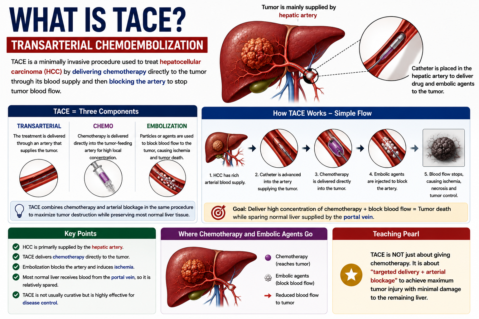 What is TACE showing transarterial catheter chemotherapy embolization and tumor control