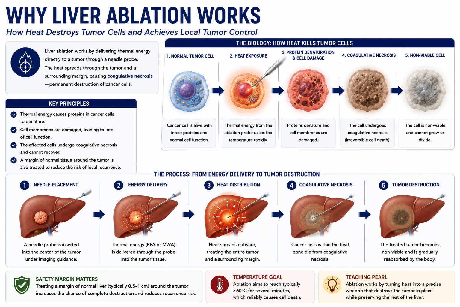 Why ablation works showing thermal energy protein denaturation cell membrane damage coagulative necrosis and tumor death